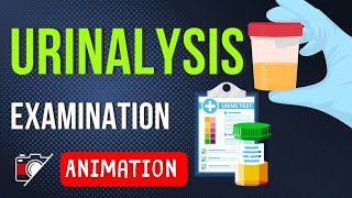 ALL ABOUT URINALYSIS  IN URINARY INFECTION  SAMPLING  INTERPRETATION  Animation [upl. by Hahsia284]