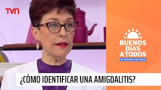 Doctora Herrera responde ¿Cómo identificar una amigdalitis  Buenos días a todos [upl. by Anatnom428]