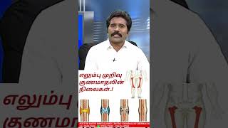 எலும்பு முறிவுக்கு Plate வைப்பது சரியா  Putturkattu Treatment  DrRSவேலுமணி  044  20002000 [upl. by Reinald548]