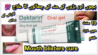 Daktarin oral gel how to usefor mouth fungel infectionDaktarin oral gel for babiesreview [upl. by Froehlich]