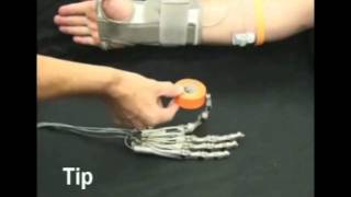 Vanderbilt MultiGrasp Hand Prosthesis [upl. by Aivata]