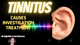 174Tinnitus Causesinvestigation and treatment tinnitus lecture ear hearingloss [upl. by Comstock]