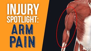 What Could Be Causing your Arm Pain [upl. by Broadbent]