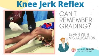 knee jerk reflex I all 4 grades with demo on patients I brisk tendon reflex rootvalue I neurology [upl. by Navoj]