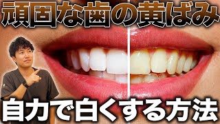 【歯を白くする方法】自力で歯の黄ばみを落とす方法を医師が解説！ [upl. by Aynna]