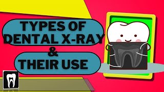 Types of Dental Xrays Dental Radiographs and Why we use them Oral Radiology Types of Radiographs [upl. by Llertnor432]