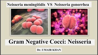 Neisseria I Gram Negative Cocci I Neisseria meningitidis VS Neisseria gonorrhoeae I Bacteriology [upl. by Kacie]