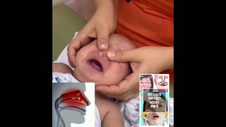 How to clear your stuffy nose in one minute parentingmethod baby [upl. by Olihs]