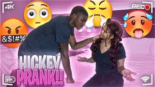 Hickey Prank on my BestfriendBAD IDEA [upl. by Asiul]