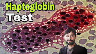 Haptoglobin Test  Haptoglobin Blood Test  MLT Hub with kamran [upl. by Yanrahc]