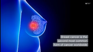 Lipid metabolism in breast cancer [upl. by Nam]