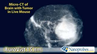 MicroCT of Live Mouse Brain Tumor after iv injection of AuroVist 15 nm Xray Contrast Agent [upl. by Enicul633]