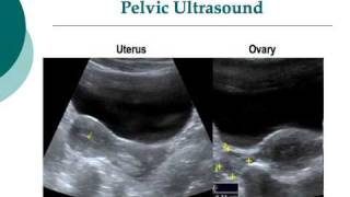 Your Radiologist Explains Pelvic amp Obstetric Ultrasound [upl. by Lezirg955]