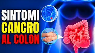 quotTumore al Colon Prevenzione Sintomi e Trattamenti [upl. by Cappello]