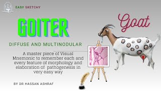 Goiter Pathology Diffuse and Multinodular  Visual Mnemonic  Endocrinology  Crack NEET PG USMLE [upl. by Aramahs104]