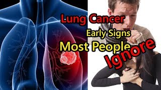 8 Early Signs of Lung Cancer Most People Ignore [upl. by Quent560]