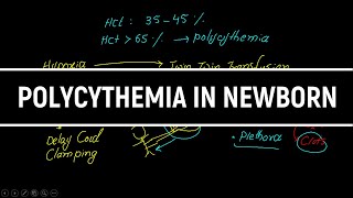 Polycythemia In Newborn Causes Presentation Investigations Treatment in HindiUrdu [upl. by Nosreip]