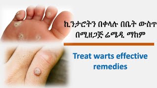 ኪንታሮትን በቀላሉ ማከም Treat warts effective remedies [upl. by Griffiths961]