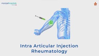 Intra Articular Injection  Manipal Hospitals Bengaluru [upl. by Iemaj]