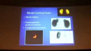 RENAL CORTICAL SCINTIGRAPHY by DRKAVITHA Prof and HOD  Nuclear medicine KREST 2015 22 [upl. by Medin]