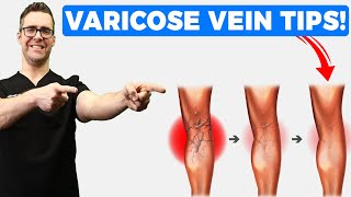 Venous Insufficiency This is the Most Effective and Safest Remedy for Varicose Veins [upl. by Carlstrom528]