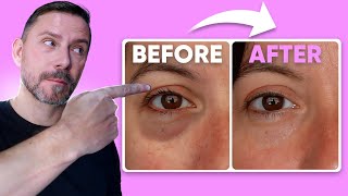 HOW TO MAKE EYE BAGS VANISH IN SECONDS FULL DEMO [upl. by Stevie405]