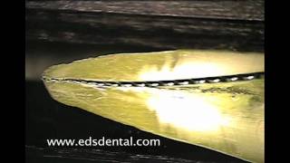 Cutting action of a endodontic file vs reamer [upl. by Kcirdle451]