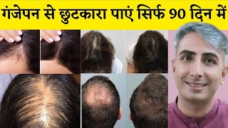 बालों का झड़ना रोकें Remedies For HAIR FALL गंजेपन से छुटकारा पाएं सिर्फ 90 दिन में  DR MANOJ DAS [upl. by Arretahs79]