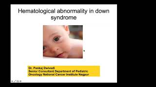 Hematological abnormalities in Down Syndrome by Dr Pankaj [upl. by Alenas]