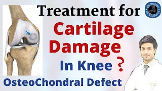 Knee Cartilage Damage Treatment  ChondralOsteochondral Defect Treatment Explained in Detail [upl. by Ycal738]