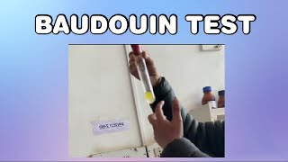 Baudouin test for Ghee [upl. by Newfeld]