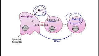 USMLE ACE Video 77 Caseating and NonCaseating Granuloma [upl. by Colburn]