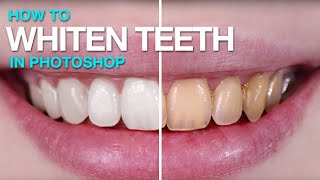 How to Whiten Teeth in Photoshop [upl. by Oluas]