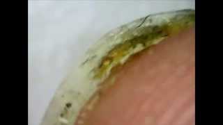 Cleaning dirty fingernails under a microscope Gross Nasty [upl. by Timothee527]