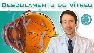 O que é Descolamento do Vítreo  Canal Retina e Vítreo [upl. by Shaefer]