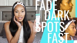 Fade Dark Spots FAST  MDAcne [upl. by Olegnaleahcim]