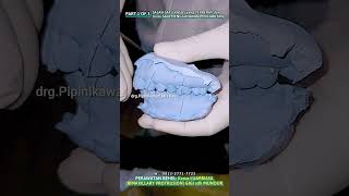 Kasus LUAR BIASA BIMAXILLARY PROTRUSION GIGI sudah MUNDUR  PART 1 OF 3 [upl. by Tompkins]