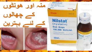 Nilstat  nystatin  oral drops  Uses and side effects in urdu and hindi [upl. by Leahcimauhsoj]