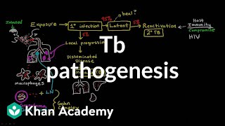 TB pathogenesis  Infectious diseases  NCLEXRN  Khan Academy [upl. by Hannahoj]