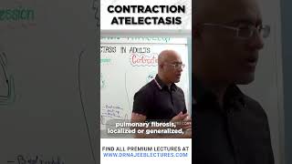 Contraction Atelectasis drnajeeb drnajeeblectures shortvideostatus [upl. by Laemsi]