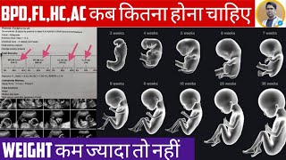 PREGNANCY ULTRASOUND REPORT IN HINDIBPDHCACFLIN PREGNANCY REPORTULTRASOUND REPORT IN HINDI [upl. by Balduin]