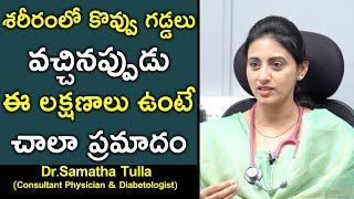 What Is Lipoma  Are They Harmful  Treatment  Dr Samatha Tulla  Health Science Telugu [upl. by Eimmat616]