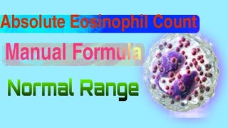 Absolute Eosinophil Count FormulaHow to count absolute eosinophilhow to count aecAEC [upl. by Namrac629]