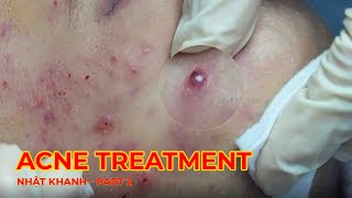 HHV Clinic  Đỗ Thu Hiền  KH Nhat Khanh Part 2 [upl. by Anbul480]