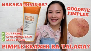 QUICKFX PIMPLE ERASER FACIAL GEL CLEANSER Review [upl. by Rus]