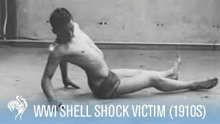 World War 1 Shell Shock Victim Recovery 1910s  War Archives [upl. by Kartis]