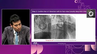 Learn the evidence  Lifetime management of aortic stenosis therapy with selfexpandable valve [upl. by Adnalro]