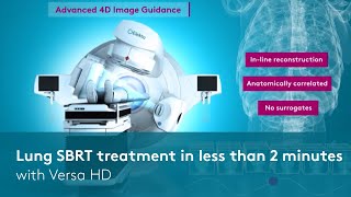 Lung SBRT treatment in less than 2 minutes with Versa HD [upl. by Margetts]