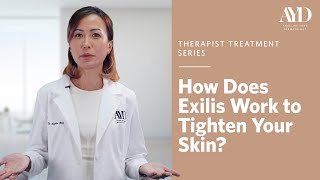 How does Exilis work to tighten your skin  Angeline Yong Dermatology [upl. by Otrevogir]