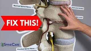 How to Fix a Bulging Disc in Your Lower Back  RELIEF IN SECONDS [upl. by Vasiliki]